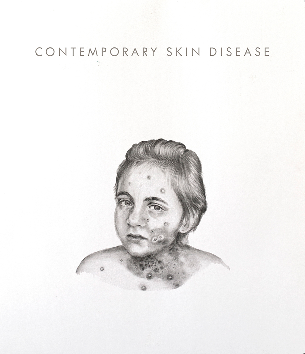 Skin disease